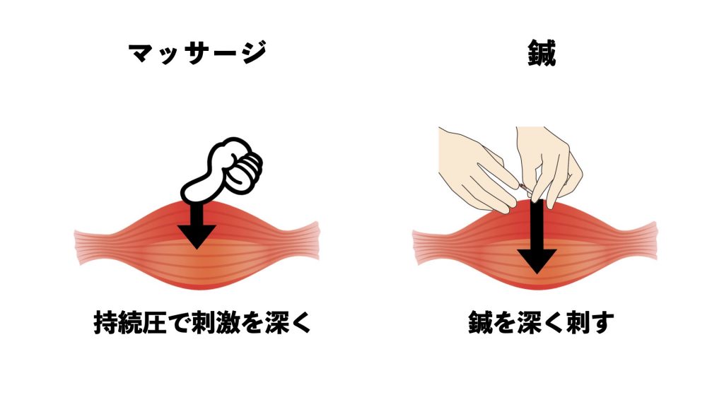 鍼とマッサージの違い